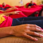 acupuncture